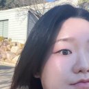 광 음 | 부산 리쥬란 잘하는 피부과 내돈내산 추천 속건조 해결 후기