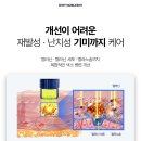 노블린