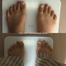 포톤테라피 | 내돈내산 치유의원 다이어트/킬레이션주사/나드주사/포톤테라피 8kg 감량 찐 후기(사무직)