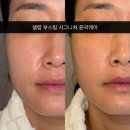 서광슈퍼 | 거제도 윤곽관리 이뻐지나 후기