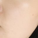 보람메디칼 이미지