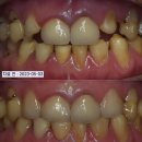 멍크라운 네이버블로그