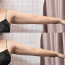 리바디짐 | 청라 에스테틱 빼빼핏 팔뚝살 에너지테라피 슬리밍 앰플 관리