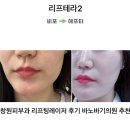 안민하나의원 | 바노바기의원 창원 피부과 리프테라2 레이저리프팅 내돈내산 솔직 후기