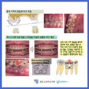 서울고운미소치과교정과치과의원 이미지