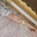 동탄행복약국 | 동탄제일아이희망 난자채취 과정과 주의사항 그리고 후기