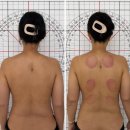 모이라 | 모이라에스테틱 체험단 후기!