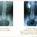 메디스톤비뇨기과 네이버블로그