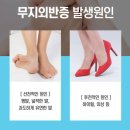 우무지 이미지