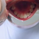 해브치과의원 네이버블로그