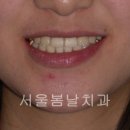 서울봄날치과교정과치과의원 이미지