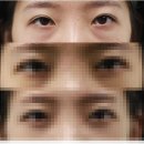 옳은손성형외과
