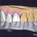 더바른치과기공소 이미지