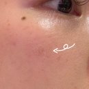 필로스의원 | 건대 쁨클리닉 스킨 보톡스 필로드 1차 후기