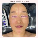 (주)벨벳케어 네이버블로그