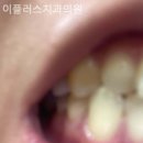 이플러스치과의원 이미지