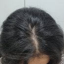 주식회사 레마온종일케어 | 두피케어 헤어볼륨 고민일 때, 이고세 헤어 뿌리볼륨샴푸 추천해요 모근강화샴푸