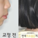 연세미소담은치과 이미지