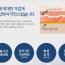 마블성형외과의원 | 리프팅 마블코 잘하는곳 강남역 성형클리닉!