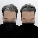 라이모플러스