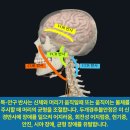 어지럼증, 이석증, 균형감 상실, 현기증의 숨은 원인은 두개경추불안정 이미지