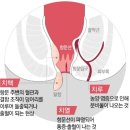 남대구약국 네이버블로그