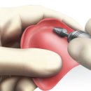 영주치과기공소 이미지