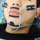 [리뷰] 수면중 입호흡방지 마우스스트랩
