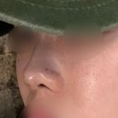 외안 | 내돈내산) 대구하이코 코리프팅 8줄 초초초 낮은납작코 조금이라도 세워보자.. 만족스러운 후기