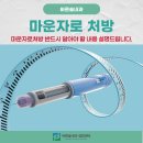 솔내과의원 | 용인마운자로처방 반드시 알아야 할 내용 설명드립니다.