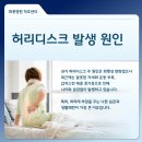 고려신경외과 네이버블로그