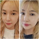 피부에서 삶으로_ 7일 아카데미로 찾아온 작은 기적(인셀덤 SGM 후기)