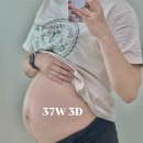 대학하나로약국 | 개금 미래여성병원 응급 제왕절개 출산, 6박 7일 입원 비용 후기 (1인실, 2인실 비교)