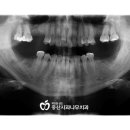 중산사과나무치과병원 이미지