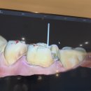 처음치과기공소 이미지