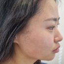 브이랜드 | 은계리프팅 세레누피부&amp;왁싱 시흥점, 구 뷰티랜드 제로브이솔직후기