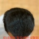 결혼식 탈모헤어고민 탈모두상성형펌으로 헤어고민타파 부산사상르네시떼6층미용실 / 남자탈모여자탈모중년탈모탈모커버부분탈모정수리탈모모류교정 이미지