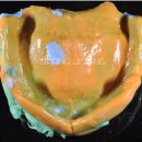 누가치과기공소 이미지