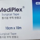 선진약국 | [병원] 피부섬유종 천안 피부섬유종 수술 후기