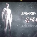 EBS 교육방송(명의) 동맥류 이미지