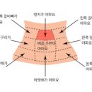 명치 통증 원인 급체 갑작스런 공복 명치쪽 불편감 왜 생길까? 이미지