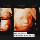솔솜 | 28주 5일, 럭키 🍀 입체초음파