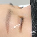 브로뷰티