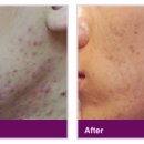 수침한의원 이미지