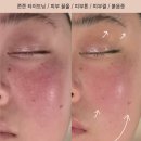 내백경로당 | 김해 리프팅탄력관리 잘하는 에스테틱 추천 백퍼센트스킨앤바디 브레핏호흡 피부관리