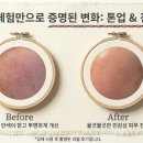 엘바이오 | 엘뤼프 필링필팩 리얼 후기 &amp; 놀라운 효과 파헤치기
