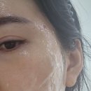 광명피부관리 인셀덤 소하점