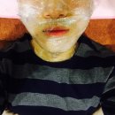 [부산 점빼기] 청담에이스 피부성형외과