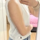침대를부탁해 | 팔뚝지방분해주사 첫회차 후기 제로컷 여름을 부탁해
