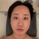 우아미 | [영주 피부관리] 영주 우아미뷰티샵 윤곽관리 + 승모근 관리 후기